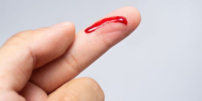 Mơ Thấy Máu Đánh Con Gì – Jun88 Giải Mã Chuẩn Tài Lộc 2025 5 Chiêm bao máu đen đánh 13 hoặc 31